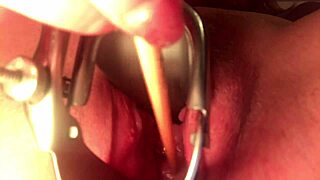 cervix stretched and sounded 😩