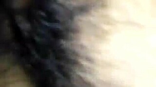 Removed all stitches from my asshole?