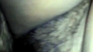 Removed all stitches from my asshole?