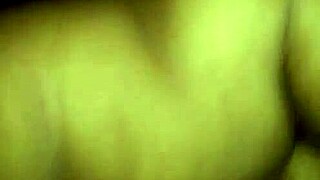 Removed all stitches from my asshole?