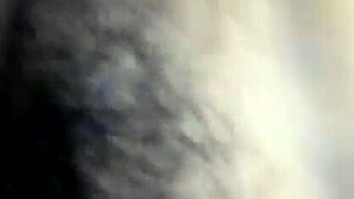 Removed all stitches from my asshole?