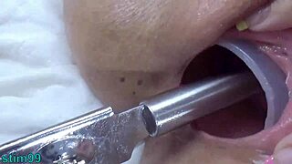 Mature Lesbians Engage In Kinky Cervix Insertion