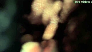 I've heard some girls worry their pigmented anal area looks dirty even if clean, but is that accurate?