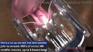 Nurse Miss Mars Latex Gloves Spreads Patient in Hospital