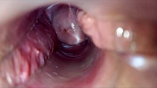 Speculum